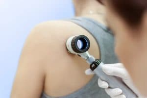  Consultanțe Dermatologice Gratuite pentru o Piele Sănătoasă în Comunități Defavorizate din România